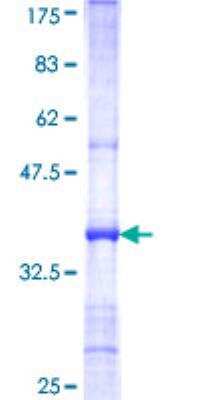 SDS-Page: Recombinant Human ARSF Protein [H00000416-Q01] - 12.5% SDS-PAGE Stained with Coomassie Blue.