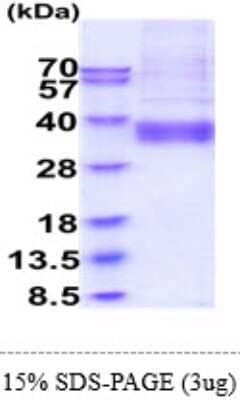 SDS-PAGE Recombinant Human ART4 His Protein