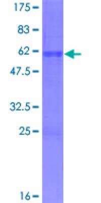 SDS-Page: Recombinant Human ASCL1/Mash1 Protein [H00000429-P01] - 12.5% SDS-PAGE Stained with Coomassie Blue.