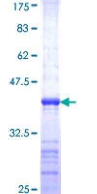 SDS-PAGE Recombinant Human ASCL1/Mash1 GST (N-Term) Protein