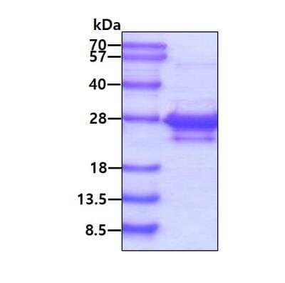SDS-PAGE Recombinant Human ASF1a His Protein