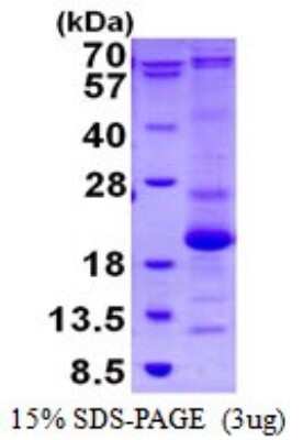 SDS-PAGE Recombinant Human ASF1b His Protein