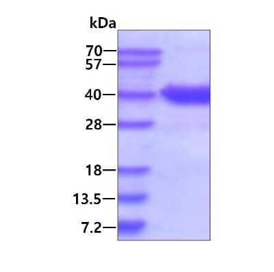 SDS-Page: Recombinant Human ASPA His Protein [NBP1-99096] - 3ug by SDS-PAGE under reducing condition and visualized by coomassie blue stain.