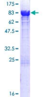 SDS-PAGE Recombinant Human ATIC GST (N-Term) Protein