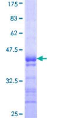 SDS-Page: Recombinant Human ATP12A Protein [H00000479-Q01] - 12.5% SDS-PAGE Stained with Coomassie Blue.