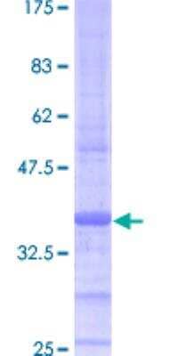 SDS-Page: Recombinant Human ATP5J Protein [H00000522-P01] - 12.5% SDS-PAGE Stained with Coomassie Blue.