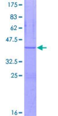 SDS-Page: Recombinant Human ATP5J Protein [H00000522-P02] - 12.5% SDS-PAGE Stained with Coomassie Blue.