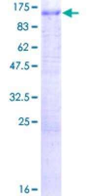 SDS-Page: Recombinant Human ATP6V0A1 Protein [H00000535-P01] - 12.5% SDS-PAGE Stained with Coomassie Blue.