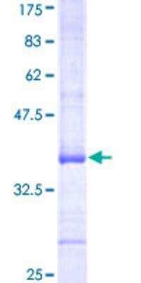 SDS-Page: Recombinant Human ATP6V0A1 Protein [H00000535-Q01] - 12.5% SDS-PAGE Stained with Coomassie Blue.