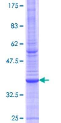 SDS-Page: Recombinant Human ATP6V1B1 Protein [H00000525-Q01] - 12.5% SDS-PAGE Stained with Coomassie Blue.