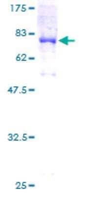 SDS-PAGE Recombinant Human ATP6V1B2 GST (N-Term) Protein