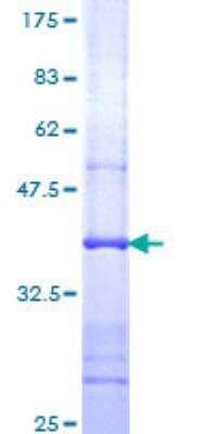 SDS-Page: Recombinant Human ATP6V1C1 Protein [H00000528-Q01] - 12.5% SDS-PAGE Stained with Coomassie Blue.