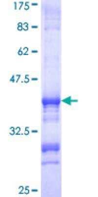 SDS-Page: Recombinant Human ATP6V1E1 Protein [H00000529-Q01] - 12.5% SDS-PAGE Stained with Coomassie Blue.