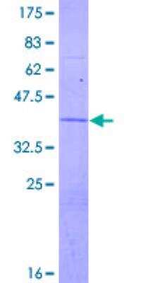 SDS-PAGE Recombinant Human ATP6V1G2 GST (N-Term) Protein