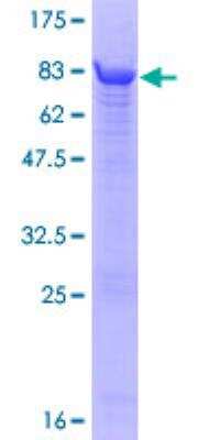 SDS-Page: Recombinant Human ATPB Protein [H00000506-P01] - 12.5% SDS-PAGE Stained with Coomassie Blue.