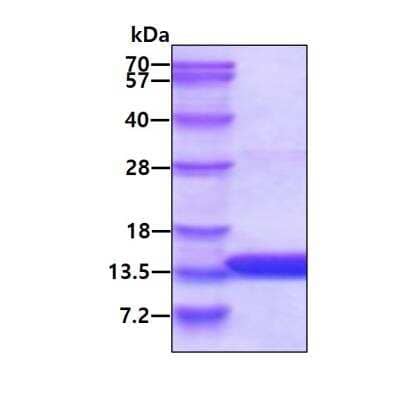 SDS-PAGE Recombinant Human ATPase Inhibitory Factor 1 His Protein