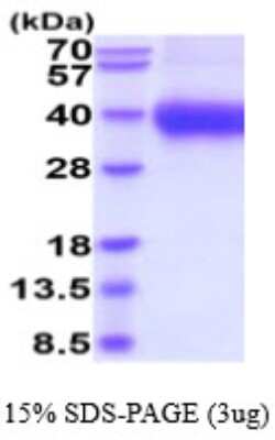 SDS-Page: Recombinant Human ATPase Na+/K+ beta 2 Protein [NBP2-59544] - 15% SDS-PAGE (3ug)