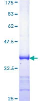 SDS-Page: Recombinant Human ATR Protein [H00000545-Q01] - 12.5% SDS-PAGE Stained with Coomassie Blue.