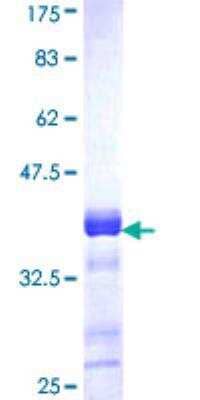 SDS-Page: Recombinant Human Acetyl Coenzyme A Carboxylase Beta Protein [H00000032-Q01] - 12.5% SDS-PAGE Stained with Coomassie Blue.