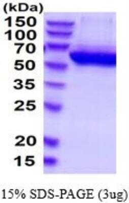 SDS-Page: Recombinant Human Adenosine Deaminase 2/CECR1 Protein [NBP2-52348]