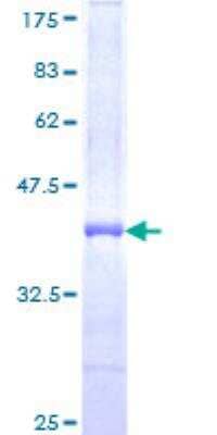 SDS-PAGE Recombinant Human Adenylate Cyclase 2 GST (N-Term) Protein