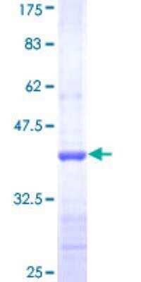 SDS-Page: Recombinant Human Adenylate Cyclase 5 Protein [H00000111-Q01] - 12.5% SDS-PAGE Stained with Coomassie Blue.