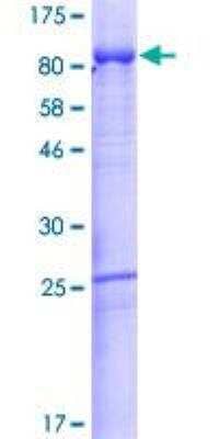 SDS-Page: Recombinant Human Afamin Protein [H00000173-P01] - 12.5% SDS-PAGE Stained with Coomassie Blue.