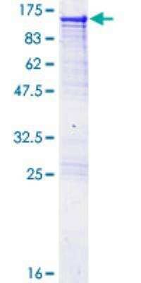 SDS-Page: Recombinant Human Alanyl tRNA synthetase Protein [H00000016-P01] - 12.5% SDS-PAGE Stained with Coomassie Blue.