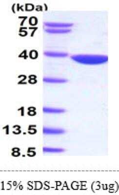 SDS-Page: Recombinant Human Aldo-keto Reductase 1B10/AKR1B10 Protein [NBC1-26377] - 15% SDS-Page (3ug).