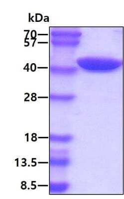 SDS-PAGE Recombinant Human Alix His Protein