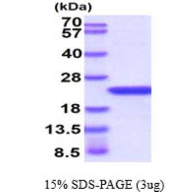 SDS-PAGE Recombinant Human AlphaB Crystallin/CRYAB Protein