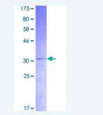 SDS-Page: Recombinant Human Amylin Protein [H00003375-P01]