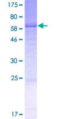 SDS-Page: Recombinant Human Ancient ubiquitous protein 1 Protein [H00000550-P01] - 12.5% SDS-PAGE Stained with Coomassie Blue.