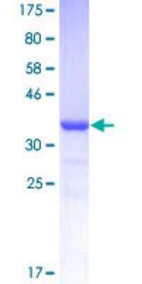 SDS-Page: Recombinant Human Androgen R/NR3C4 Protein [H00000367-Q01] - 12.5% SDS-PAGE Stained with Coomassie Blue.