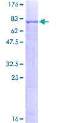 SDS-Page: Recombinant Human Angiopoietin-like Protein 1/ANGPTL1 Protein [H00009068-P01] - 12.5% SDS-PAGE Stained with Coomassie Blue.
