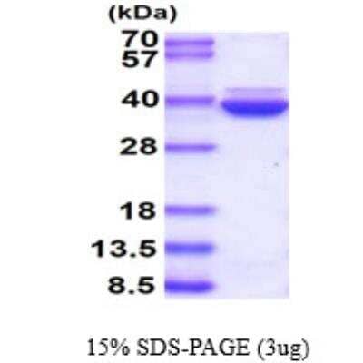 SDS-Page: Recombinant Human Annexin A8/ANXA8 Protein [NBP1-48328] - 3ug by SDS-PAGE under reducing condition and visualized by coomassie blue stain