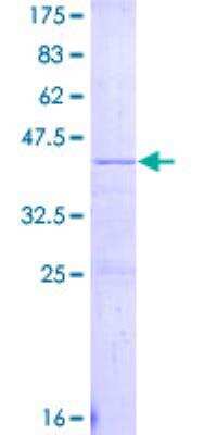 SDS-Page: Recombinant Human Apolipoprotein C4 Protein [H00000346-P01] - 12.5% SDS-PAGE Stained with Coomassie Blue.