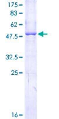 Recombinant Human Apolipoprotein L1 Protein [H00008542-P01] - 12.5% SDS-PAGE Stained with Coomassie Blue.