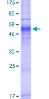 SDS-Page: Recombinant Human Aquaporin-7 Protein [H00000364-P01] - 12.5% SDS-PAGE Stained with Coomassie Blue.