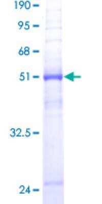 SDS-PAGE Recombinant Human Aquaporin-8 GST (N-Term) Protein