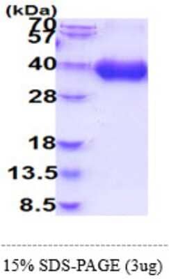 SDS-Page: Recombinant Human B7-1/CD80 Protein [NBP2-60217] - 15 % SDS-PAGE (3ug)
