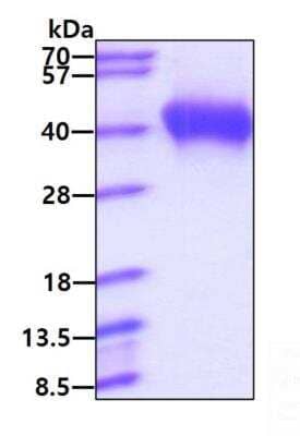 SDS-Page: Recombinant Human B7-2/CD86 His Protein [NBP2-77486] - 3ug by SDS-PAGE under reducing condition and visualized by coomassie blue stain.