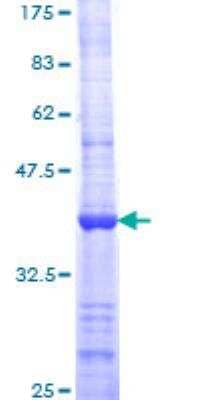 SDS-Page: Recombinant Human BARD1 Protein [H00000580-Q01] - 12.5% SDS-PAGE Stained with Coomassie Blue.