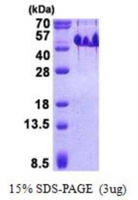 SDS-Page: Recombinant Human BASP1 Protein [NBP2-22717]