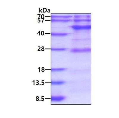 SDS-Page: Recombinant Human BCKDHA Protein [NBP1-51018] - 3ug by SDS-PAGE under reducing condition and visualized by coomassie blue stain