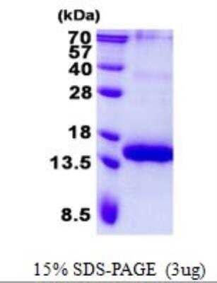 SDS-Page: Recombinant Human BCMA/TNFRSF17 Protein [NBP2-22905]