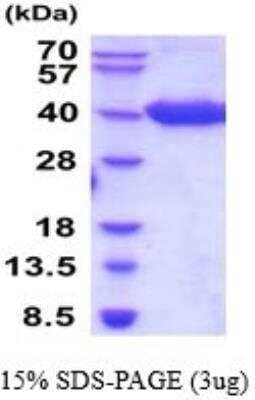 SDS-Page: Recombinant Human BCMA/TNFRSF17 Protein [NBP2-52270]