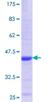 SDS-Page: Recombinant Human BCR Protein [H00000613-Q01] - 12.5% SDS-PAGE Stained with Coomassie Blue.