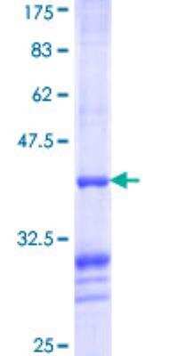 SDS-Page: Recombinant Human BCS1L Protein [H00000617-Q01] - 12.5% SDS-PAGE Stained with Coomassie Blue.