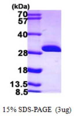 SDS-Page: Recombinant Human BDH2 Protein [NBP1-50963] - 15 % SDS-PAGE (3ug)